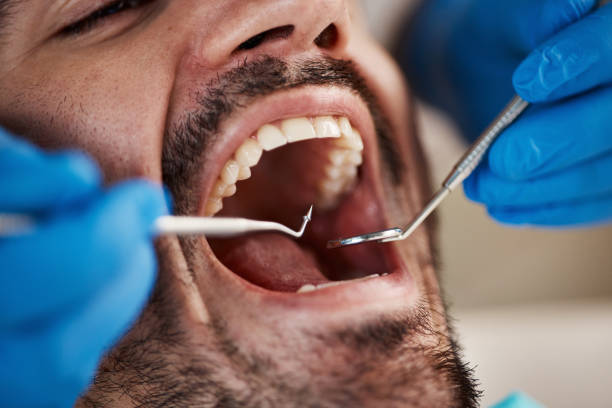 Best Emergency Gum Treatment in Eufaula, AL